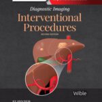خرید و دانلود نسخه کامل کتاب Interventional Procedures