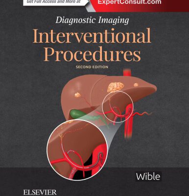 خرید و دانلود نسخه کامل کتاب Interventional Procedures