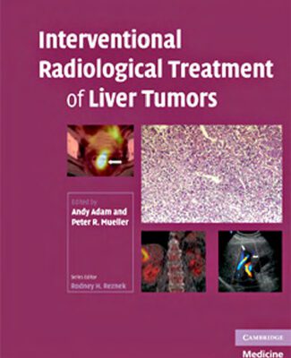 خرید و دانلود نسخه کامل کتاب Interventional Radiological Treatment of Liver Tumors (Contemporary Issues in Cancer Imaging)