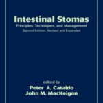 خرید و دانلود نسخه کامل کتاب Intestinal Stomas: Principles: Techniques, and Management, Second Edition,