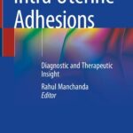 خرید و دانلود نسخه کامل کتاب Intra Uterine Adhesions: Diagnostic and Therapeutic Insight