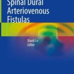 خرید و دانلود نسخه کامل کتاب Intracranial and Spinal Dural Arteriovenous Fistulas
