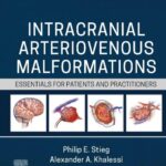 خرید و دانلود نسخه کامل کتاب Intracranial Arteriovenous Malformations: Essentials for Patients and Practitioners