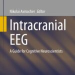 خرید و دانلود نسخه کامل کتاب Intracranial EEG: A Guide for Cognitive Neuroscientists