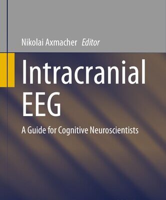 خرید و دانلود نسخه کامل کتاب Intracranial EEG: A Guide for Cognitive Neuroscientists