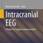 خرید و دانلود نسخه کامل کتاب Intracranial EEG: A Guide for Cognitive Neuroscientists