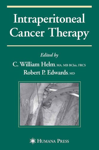 خرید و دانلود نسخه کامل کتاب Intraperitoneal Cancer Therapy (Current Clinical Oncology)_68bb2c6097af1.jpeg خرید و دانلود نسخه کامل کتاب Intraperitoneal Cancer Therapy (Current Clinical Oncology)