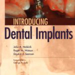 خرید و دانلود نسخه کامل کتاب Introducing Dental Implants