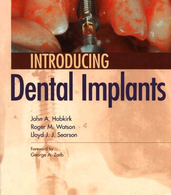 خرید و دانلود نسخه کامل کتاب Introducing Dental Implants