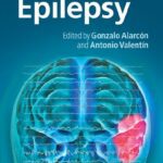 خرید و دانلود نسخه کامل کتاب Introduction to Epilepsy