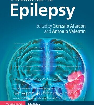 خرید و دانلود نسخه کامل کتاب Introduction to Epilepsy