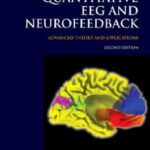 خرید و دانلود نسخه کامل کتاب Introduction to Quantitative EEG and Neurofeedback: Advanced Theory and Applications