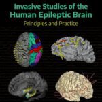 خرید و دانلود نسخه کامل کتاب Invasive Studies of the Human Epileptic Brain: Principles and Practice