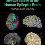 خرید و دانلود نسخه کامل کتاب Invasive Studies of the Human Epileptic Brain Principles and Practice