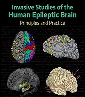 خرید و دانلود نسخه کامل کتاب Invasive Studies of the Human Epileptic Brain Principles and Practice