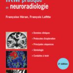 خرید و دانلود نسخه کامل کتاب IRM pratique en neuroradiologie