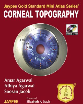 خرید و دانلود نسخه کامل کتاب Jaypee Gold Standard Mini Atlas Series: Corneal Topography