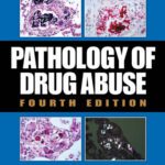 خرید و دانلود نسخه کامل کتاب Karch’s Pathology of Drug Abuse, Fourth Edition