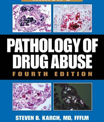 خرید و دانلود نسخه کامل کتاب Karch’s Pathology of Drug Abuse, Fourth Edition