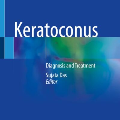 خرید و دانلود نسخه کامل کتاب Keratoconus: Diagnosis and Treatment