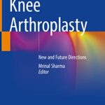 خرید و دانلود نسخه کامل کتاب Knee Arthroplasty: New and Future Directions