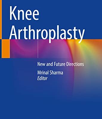 خرید و دانلود نسخه کامل کتاب Knee Arthroplasty: New and Future Directions