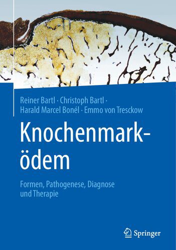 خرید و دانلود نسخه کامل کتاب Knochenmarködem: Formen, Pathogenese, Diagnose und Therapie_68b5e45896e0a.jpeg خرید و دانلود نسخه کامل کتاب Knochenmarködem: Formen, Pathogenese, Diagnose und Therapie