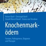 خرید و دانلود نسخه کامل کتاب Knochenmarködem: Formen, Pathogenese, Diagnose und Therapie