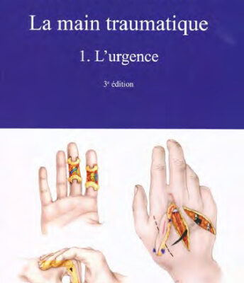خرید و دانلود نسخه کامل کتاب La main traumatique : Tome 1, L’urgence