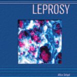 خرید و دانلود نسخه کامل کتاب Leprosy (Deadly Diseases and Epidemics)
