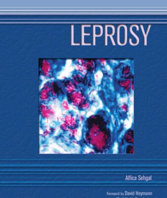 خرید و دانلود نسخه کامل کتاب Leprosy (Deadly Diseases and Epidemics)