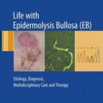 خرید و دانلود نسخه کامل کتاب Life with Epidermolysis Bullosa (EB): Etiology, Diagnosis, Multidisciplinary Care and Therapy