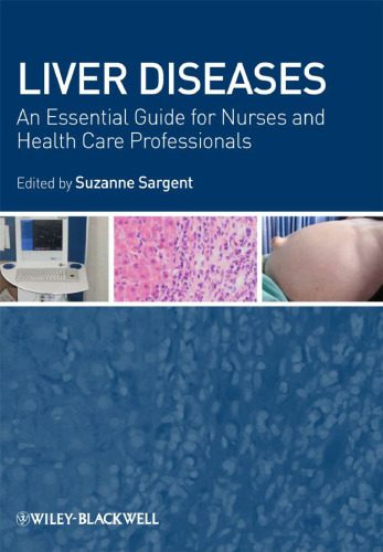 خرید و دانلود نسخه کامل کتاب Liver Diseases: An Essential Guide for Nurses and Health Care Professionals_68b9b0f71c579.jpeg خرید و دانلود نسخه کامل کتاب Liver Diseases: An Essential Guide for Nurses and Health Care Professionals