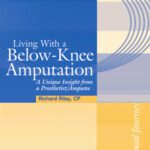خرید و دانلود نسخه کامل کتاب Living with a Below-Knee Amputation: A Unique Insight from a Prosthetist/Amputee