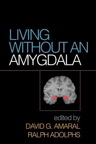 خرید و دانلود نسخه کامل کتاب Living Without an Amygdala_68bb3cbd08a02.jpeg خرید و دانلود نسخه کامل کتاب Living Without an Amygdala