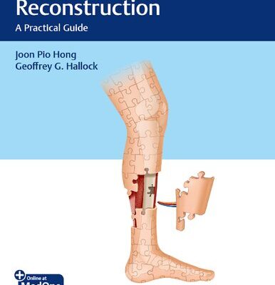 خرید و دانلود نسخه کامل کتاب Lower Extremity Reconstruction: A Practical Guide