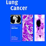 خرید و دانلود نسخه کامل کتاب Lung Cancer (Contemporary Issues in Cancer Imaging)
