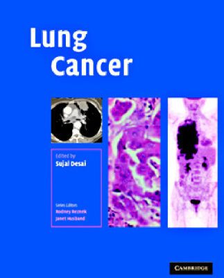 خرید و دانلود نسخه کامل کتاب Lung Cancer (Contemporary Issues in Cancer Imaging)