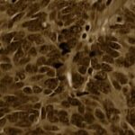 خرید و دانلود نسخه کامل کتاب Lung Cancer: Diagnostic and Therapeutic Methods and Reviews