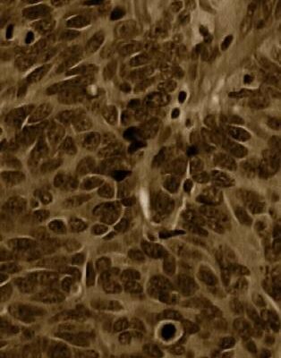 خرید و دانلود نسخه کامل کتاب Lung Cancer: Diagnostic and Therapeutic Methods and Reviews