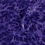 خرید و دانلود نسخه کامل کتاب Lung Cancer: Molecular Pathology Methods and Reviews