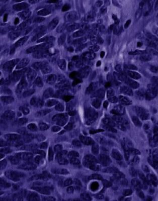 خرید و دانلود نسخه کامل کتاب Lung Cancer: Molecular Pathology Methods and Reviews