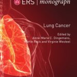 خرید و دانلود نسخه کامل کتاب Lung Cancer