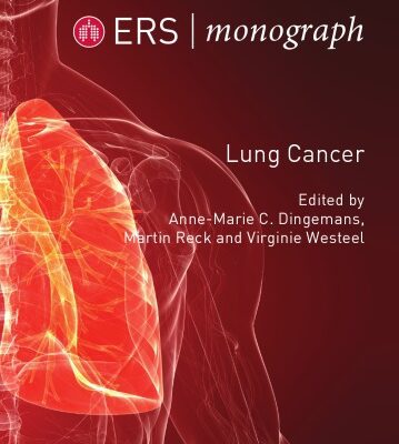خرید و دانلود نسخه کامل کتاب Lung Cancer