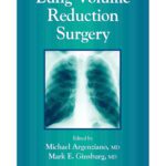 خرید و دانلود نسخه کامل کتاب Lung Volume Reduction Surgery