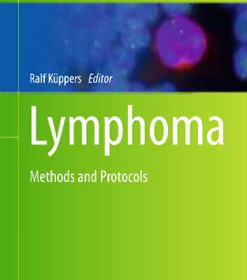 خرید و دانلود نسخه کامل کتاب Lymphoma: Methods and Protocols