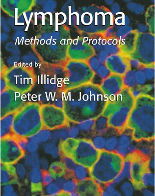 خرید و دانلود نسخه کامل کتاب Lymphoma (Methods in Molecular Medicine)