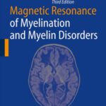 خرید و دانلود نسخه کامل کتاب Magnetic Resonance of Myelination and Myelin Disorders