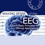 خرید و دانلود نسخه کامل کتاب Making Sense of the EEG: From Basic Principles to Clinical Applications