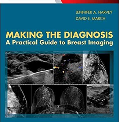 خرید و دانلود نسخه کامل کتاب Making the Diagnosis: A Practical Guide to Breast Imaging